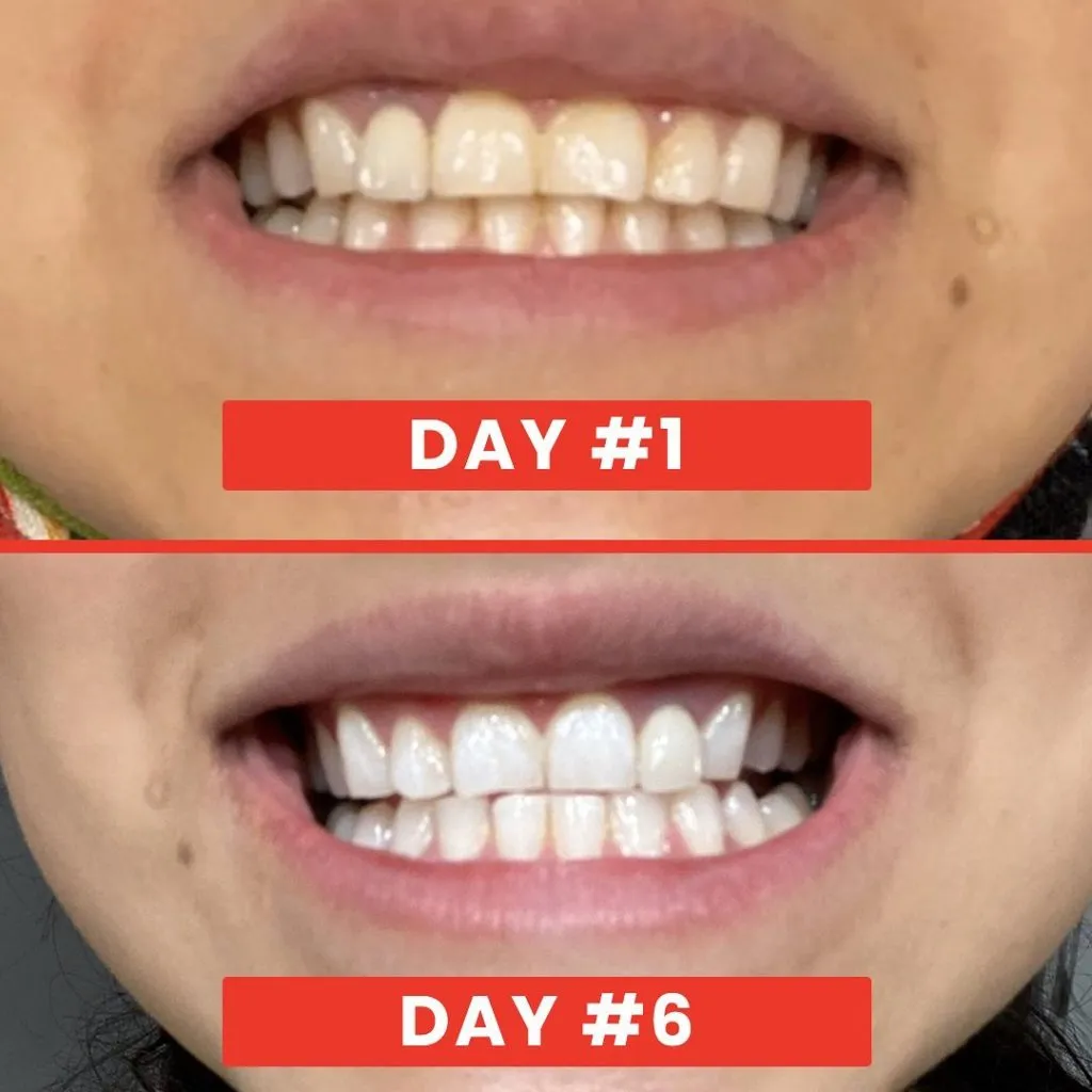 32232 zimba whitening products