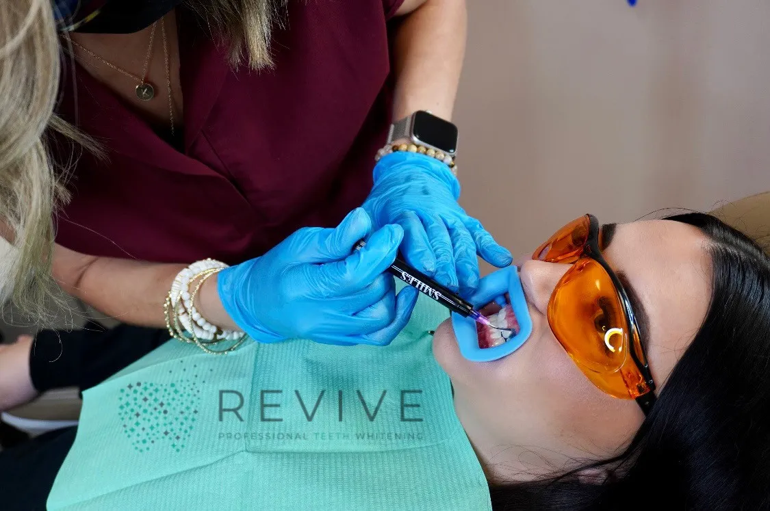 32249 in office teeth whitening