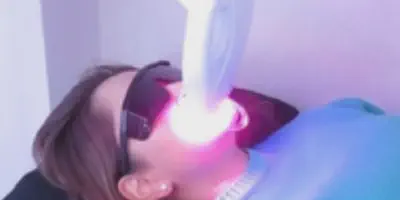 /img/32252-teeth-whitening-results.webp