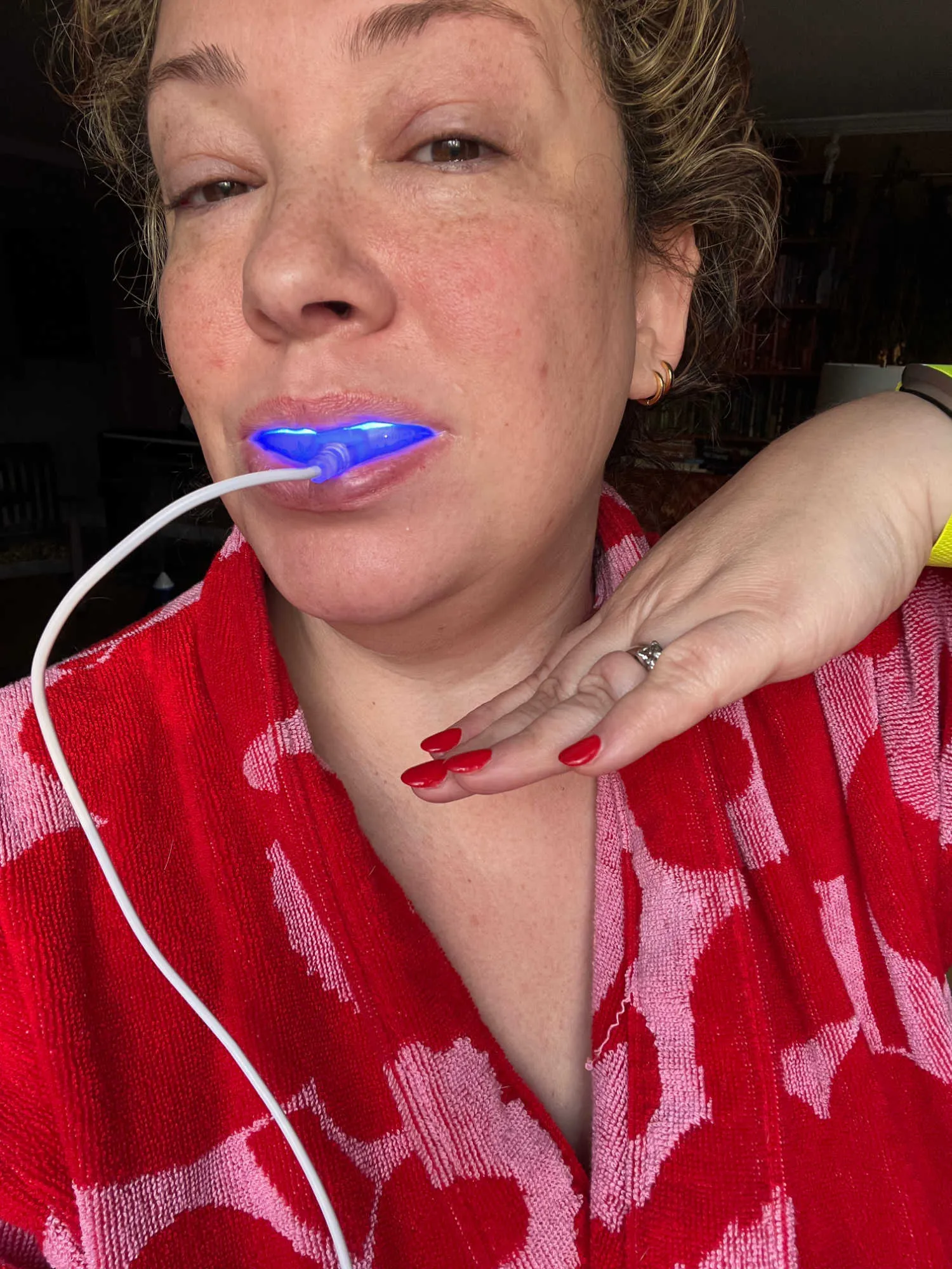 /img/32257-snow-teeth-whitening-comparison.webp
