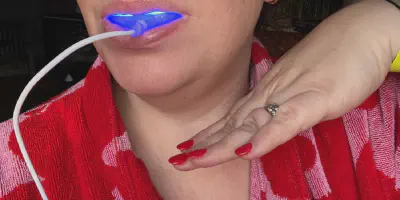 /img/32257-snow-teeth-whitening-comparison.webp