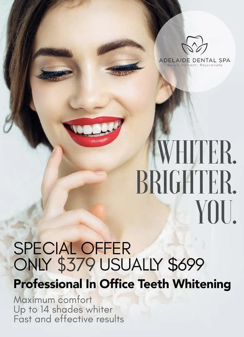 32259 teeth whitening adelaide take home kit