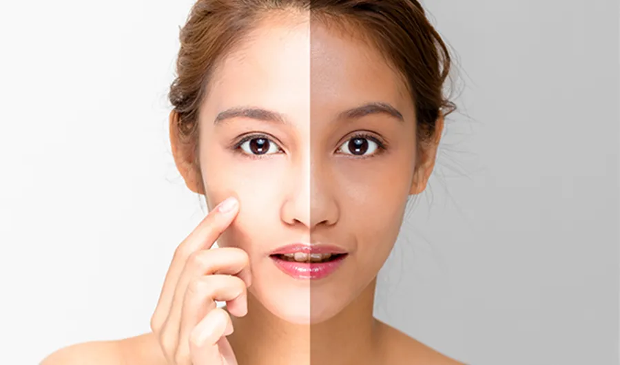 32262 face skin discoloration