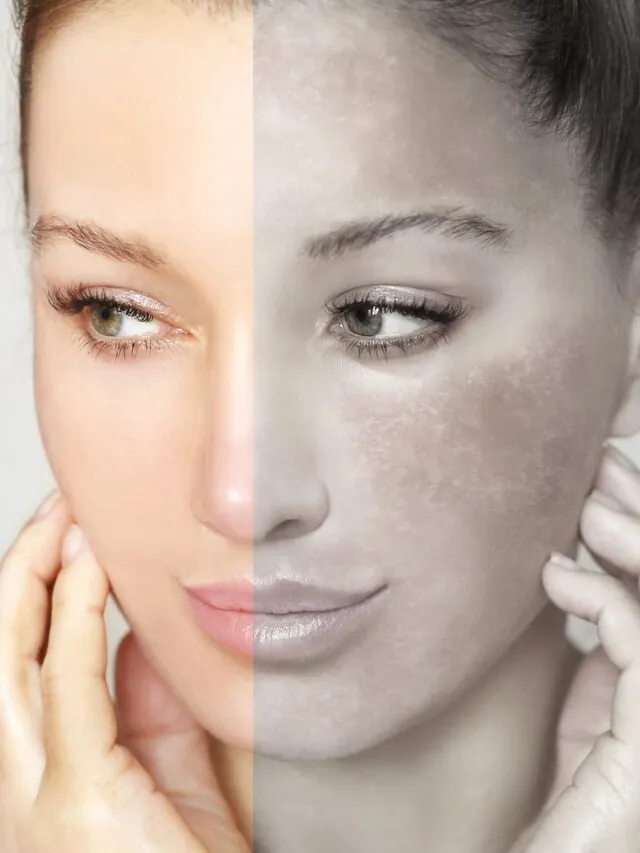 32262 sun exposure face skin