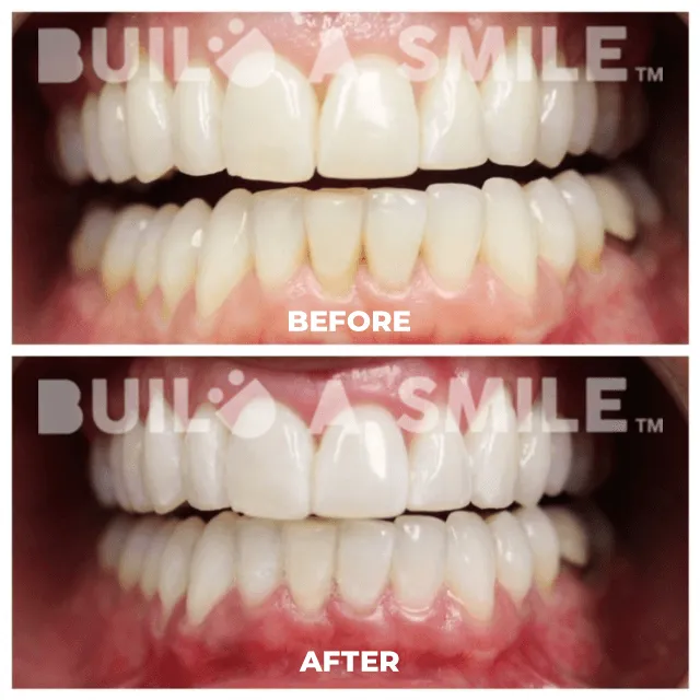 /img/32263-teeth-whitening-nc-results.webp