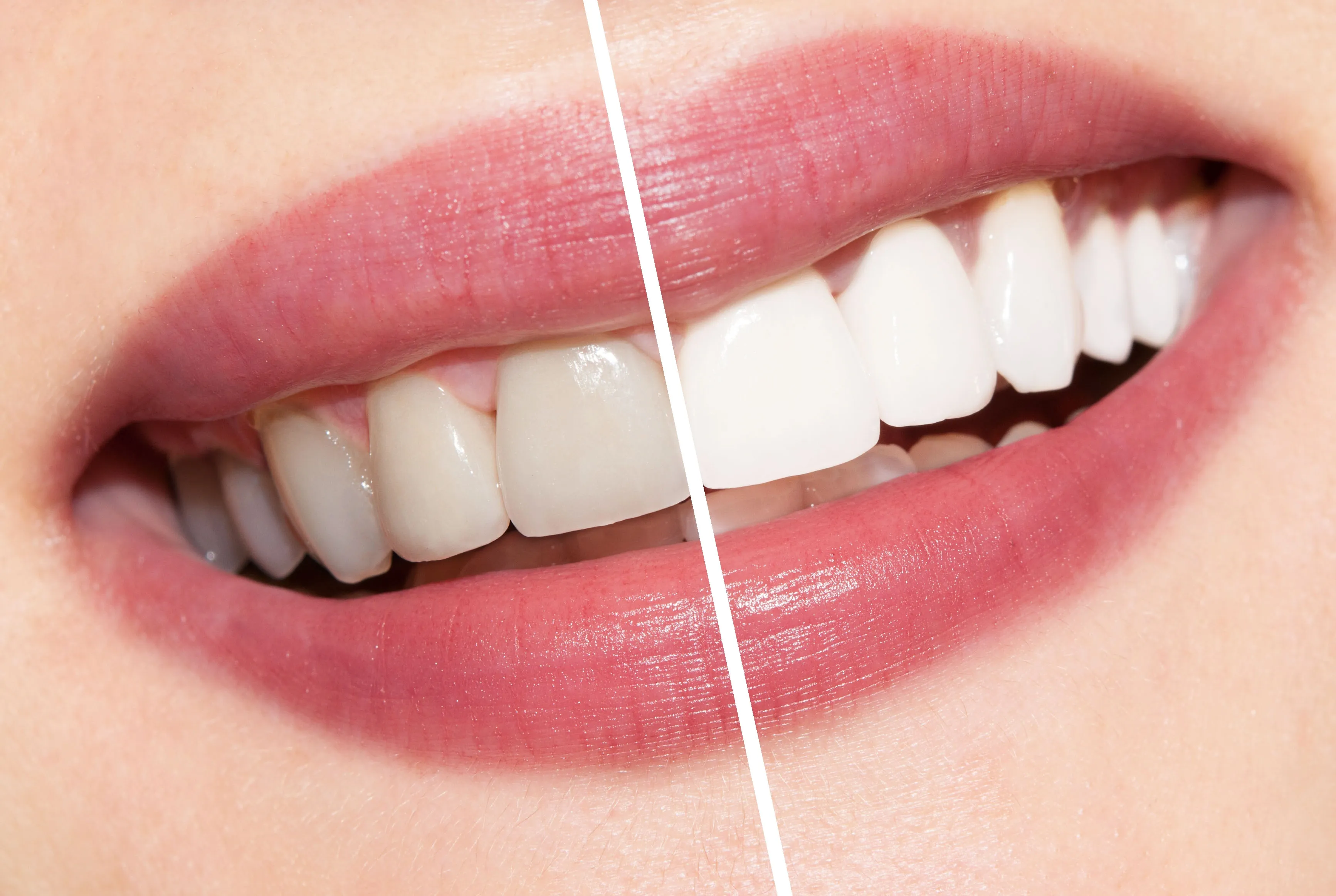 /img/32265-oral-hygiene-practices.webp