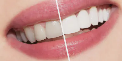 /img/32265-oral-hygiene-practices.webp