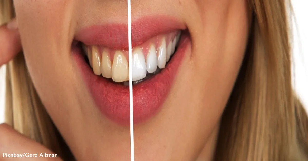32265 whitening toothpaste
