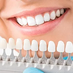 32267 tooth shade guide