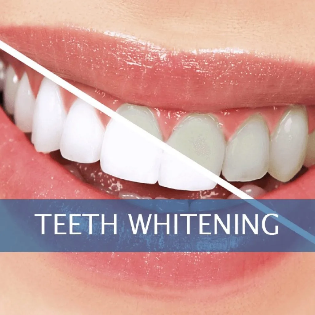 32269 teeth whitening solution 1