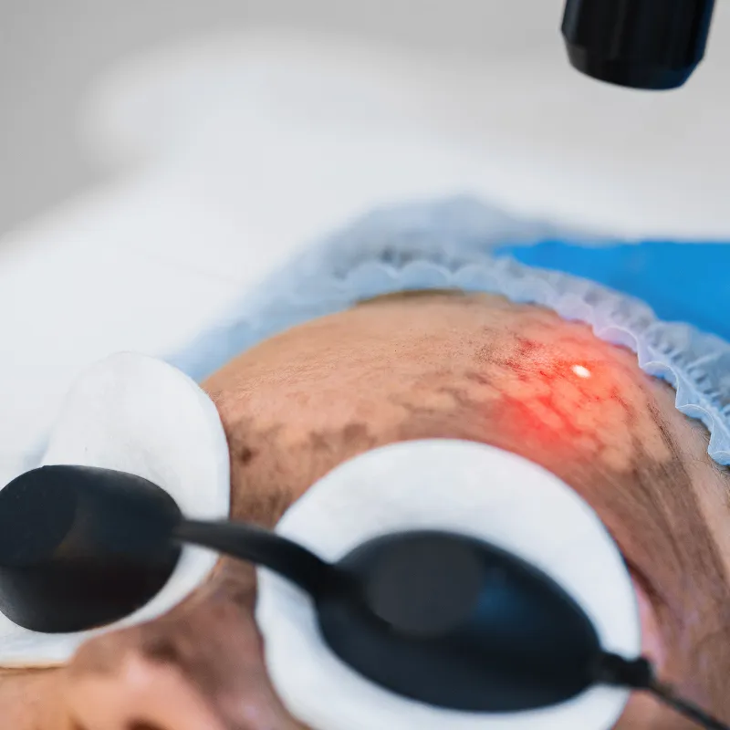 32270 collagen production enhancement