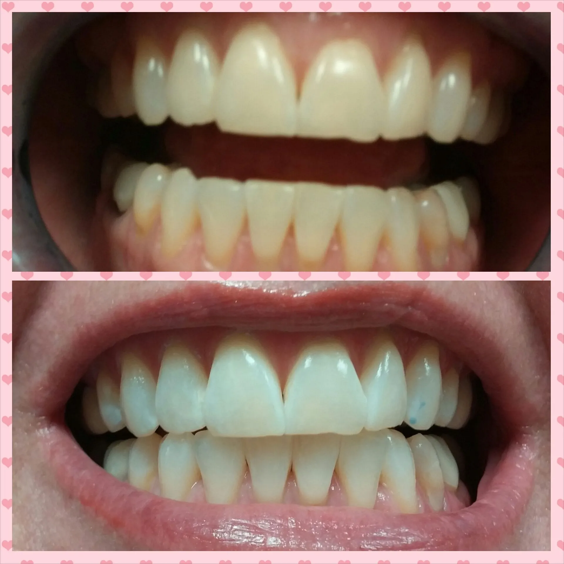 32270 hyperpigmentation reduction