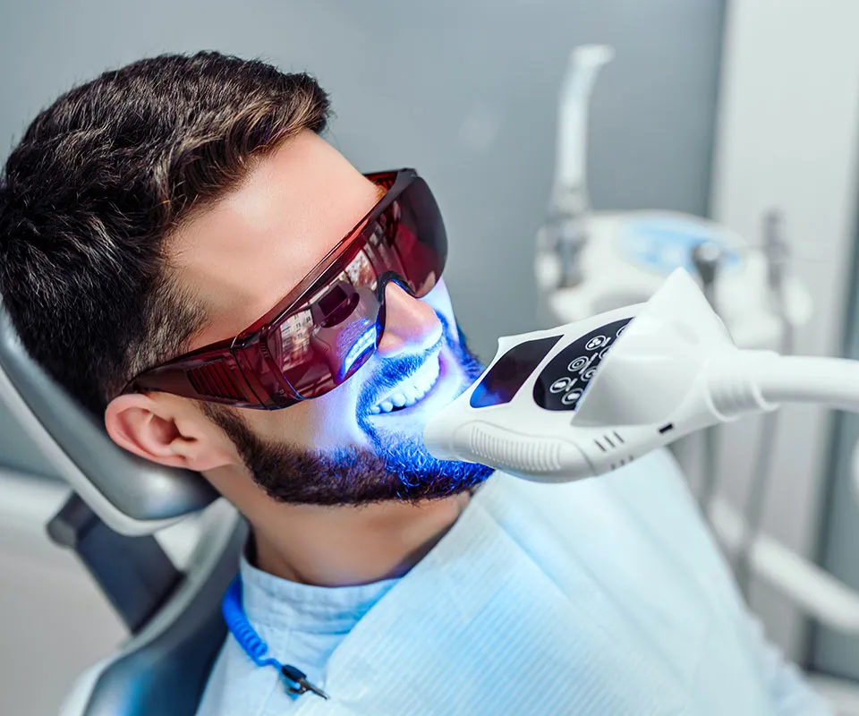 32272 professional teeth whitening