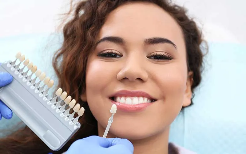 /img/32274-maintaining-teeth-whitening.webp