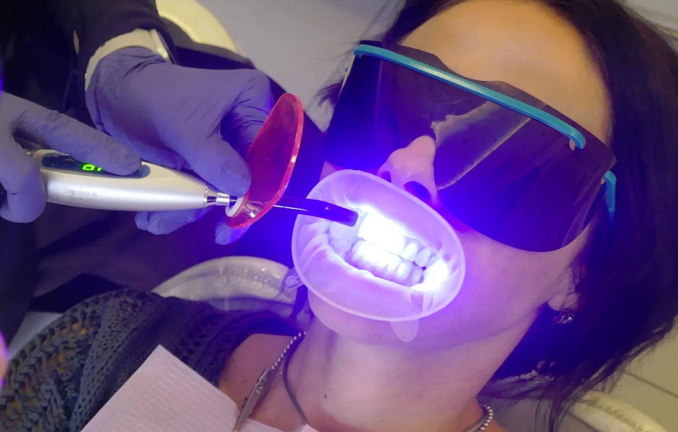 /img/32275-uv-teeth-whitening-7.webp