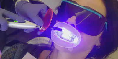 /img/32275-uv-teeth-whitening-7.webp