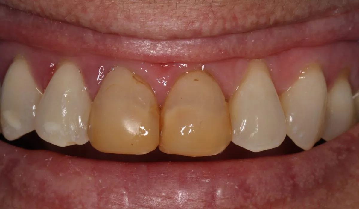 /img/32277-kor-whitening-aftercare.webp