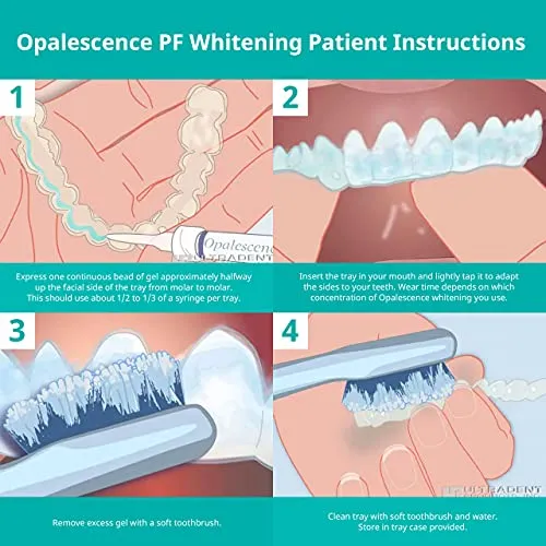32283 teeth whitening results