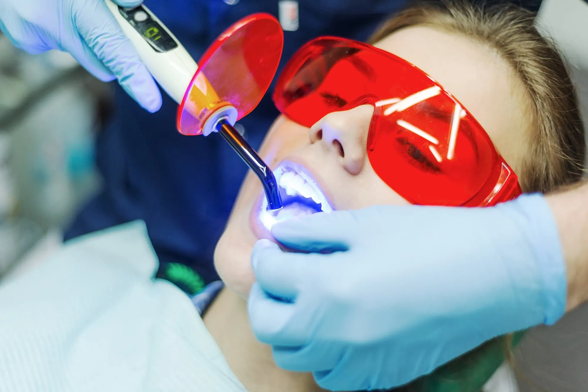 32284 teeth whitening cost