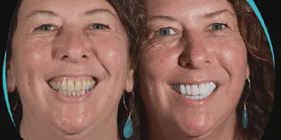 /img/32286-cancun-clinic-reviews.webp