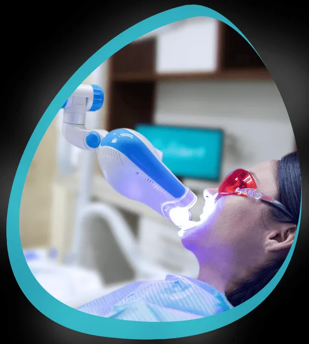 32286 cancun teeth whitening cost
