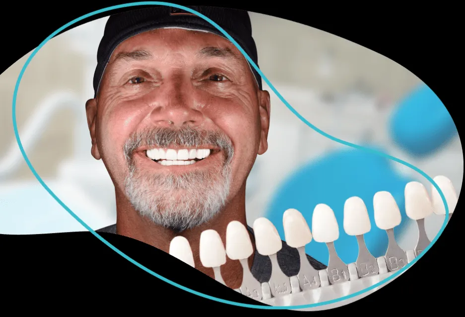 32286 in office teeth whitening