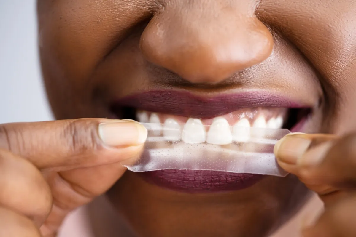 32289 teeth whitening strip application