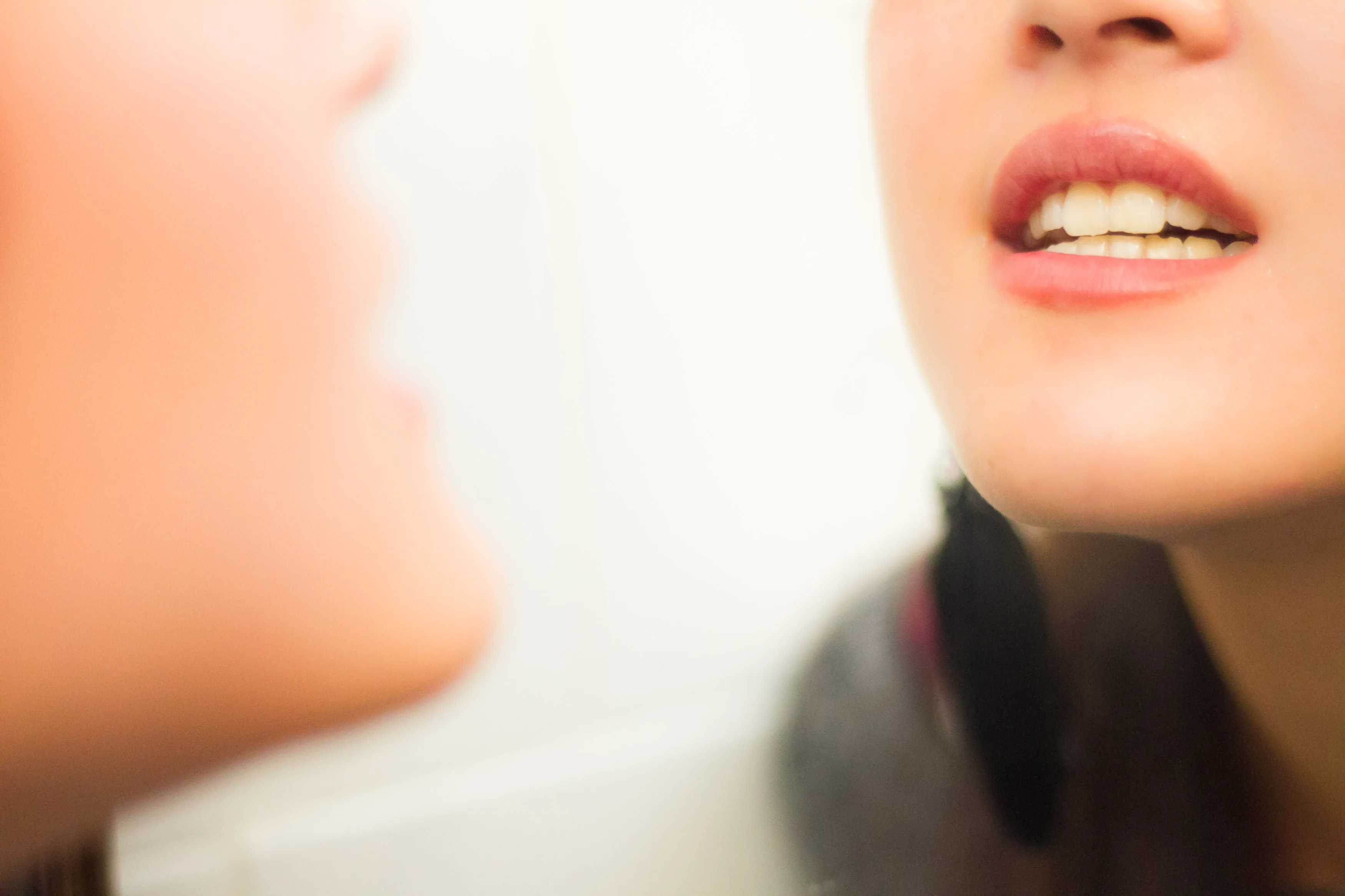 32289 teeth whitening teeth