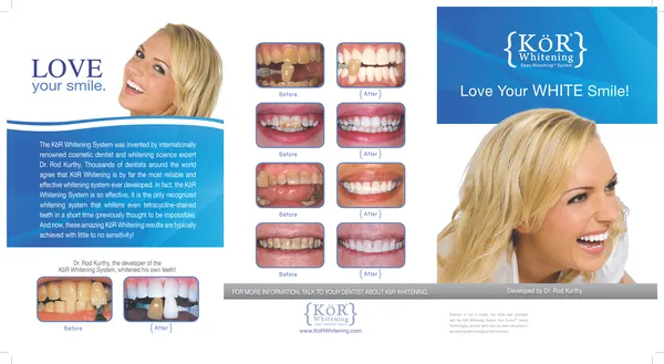 32293 kor whitening cost factors