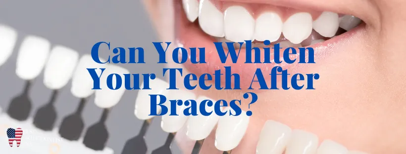 32296 teeth whitening after braces 2
