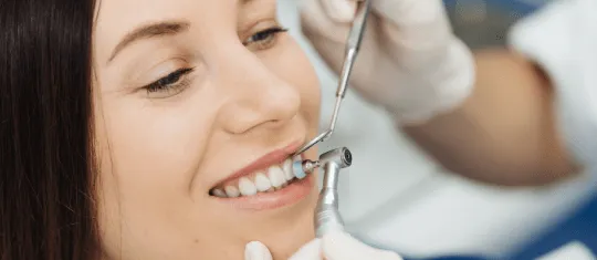 32297 professional teeth whitening