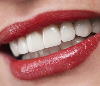 /img/32297-teeth-whitening-aftercare.webp