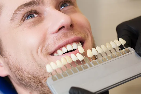 32298 groupon teeth whitening