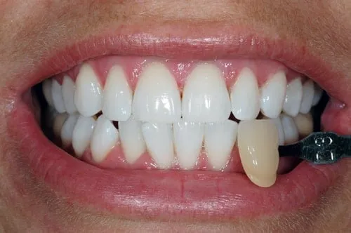/img/32298-happy-customer.webp