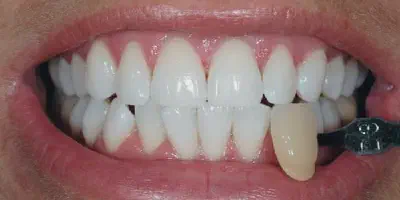 /img/32298-happy-customer.webp