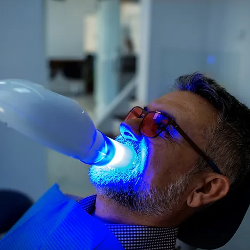 32300 at home tooth whitening