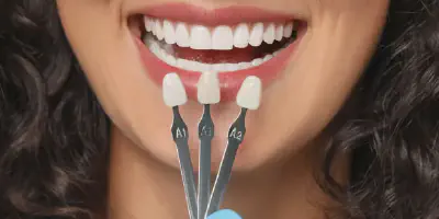 /img/32300-finding-dentist-thousand-oaks.webp