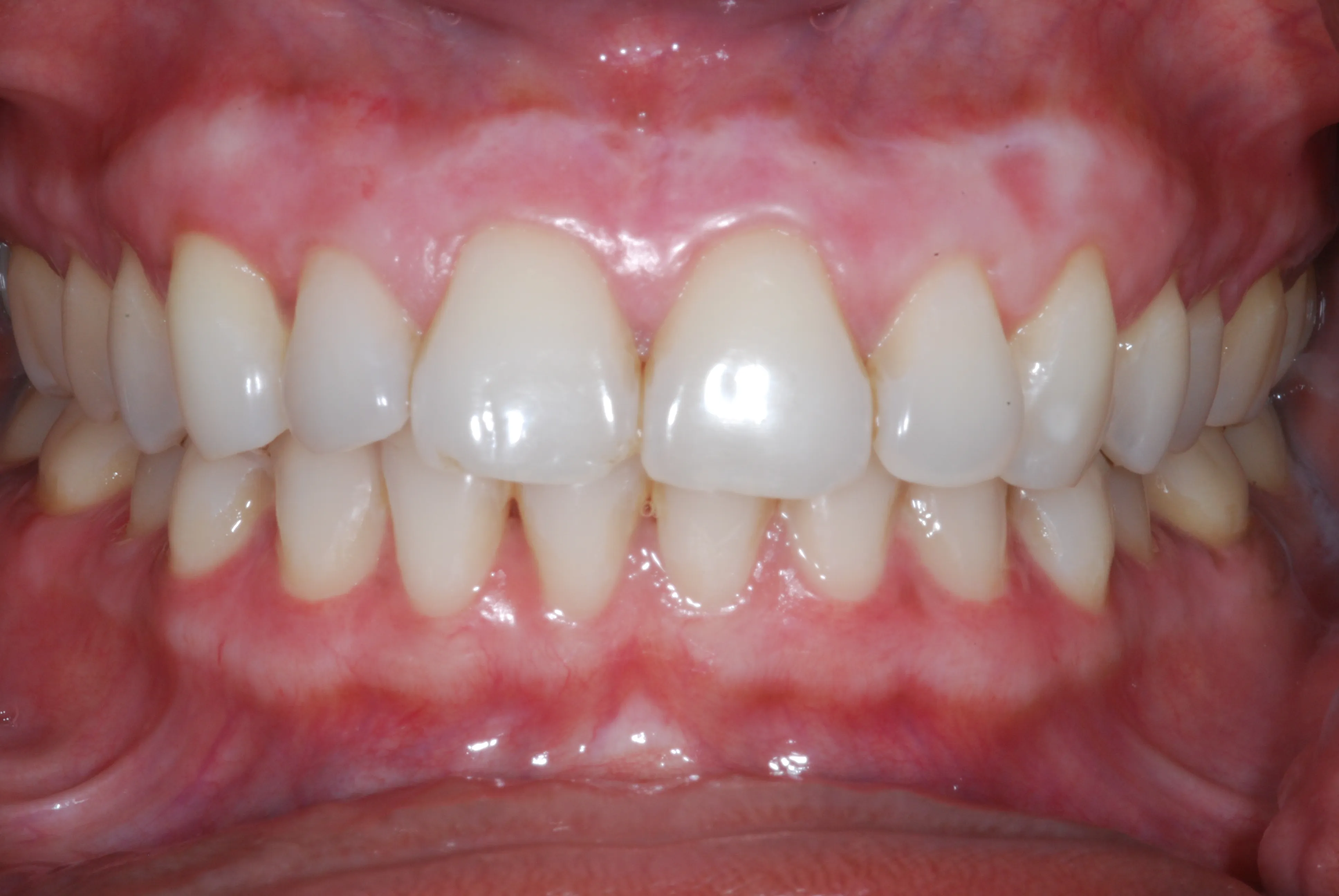 32301 brushing flossing