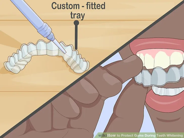 /img/32301-dental-checkup.webp