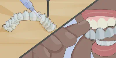 /img/32301-dental-checkup.webp