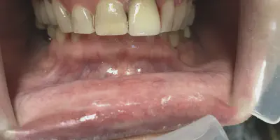 /img/32303-teeth-whitening-smile.webp