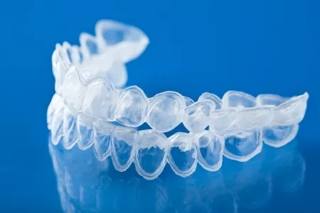 32305 filling whitening trays