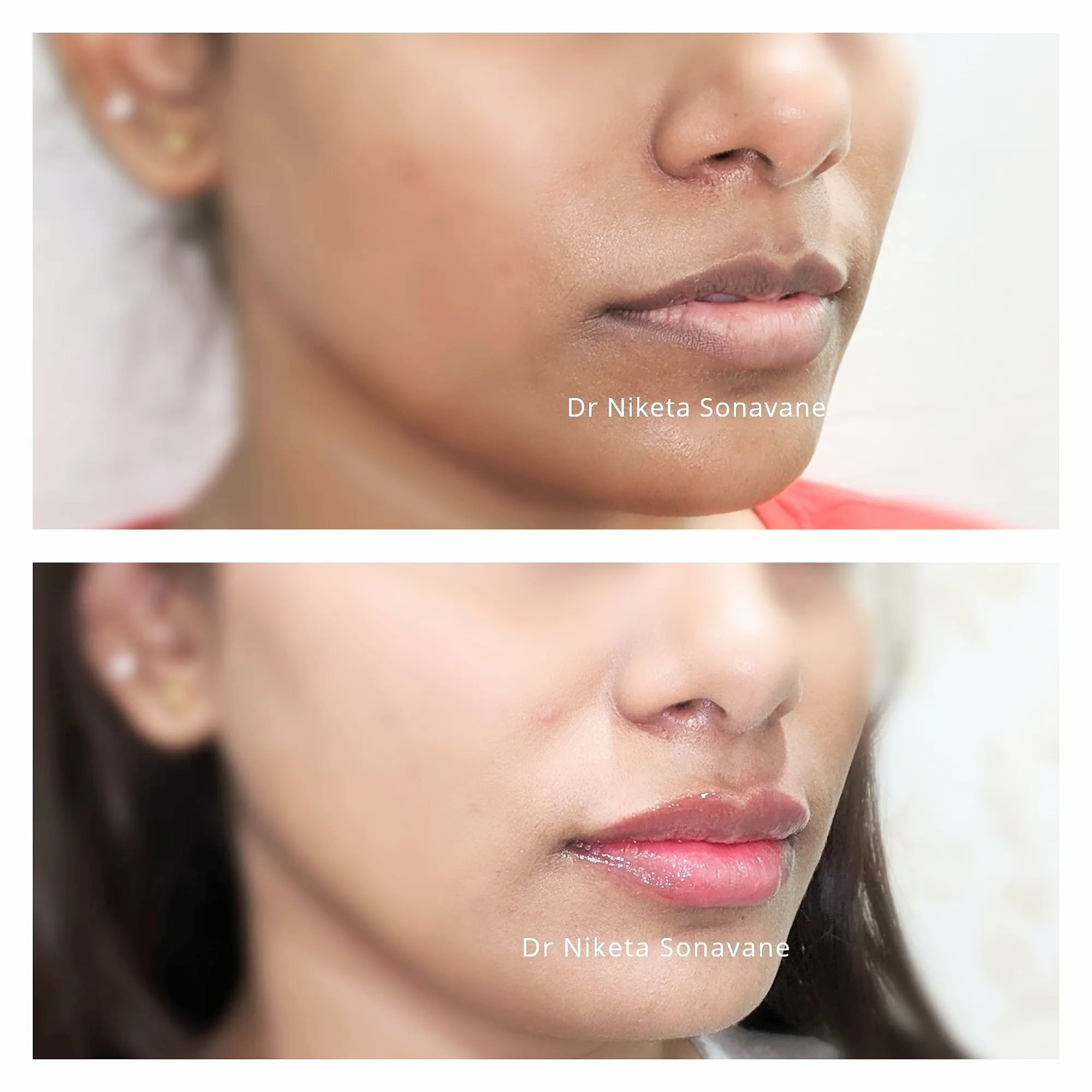 /img/32315-researching-skin-whitening-clinics.webp