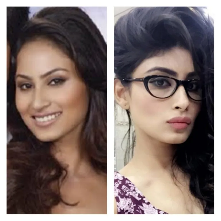 32315 skin whitening before after