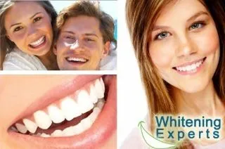 /img/32319-teeth-whitening-aftercare.webp