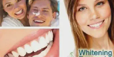 /img/32319-teeth-whitening-aftercare.webp