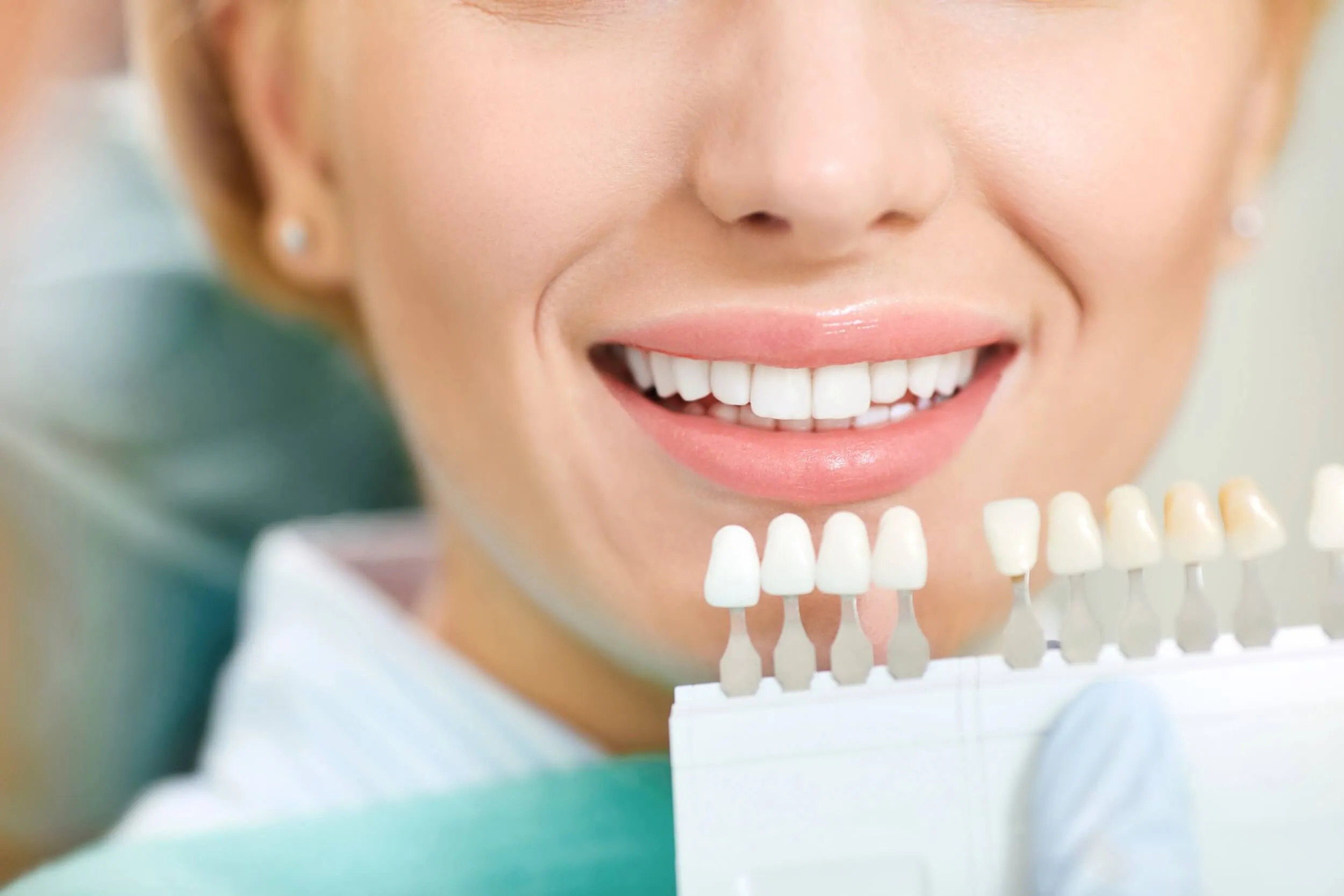 32319 teeth whitening at home