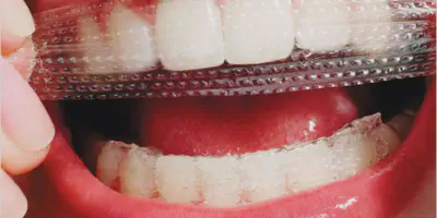 /img/32327-oral-health-routine.webp