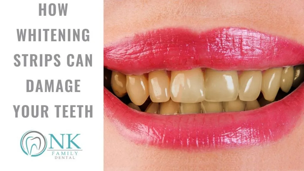 32327 professional teeth whitening