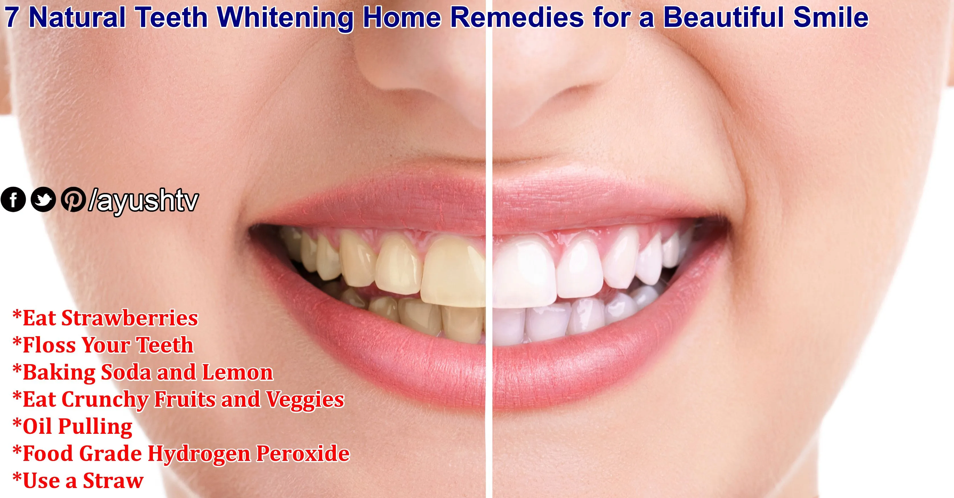 32330 healthy teeth and gums